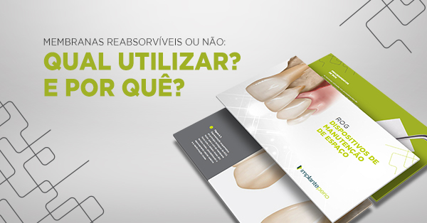 Recessões gengivais unitárias, como tratar?